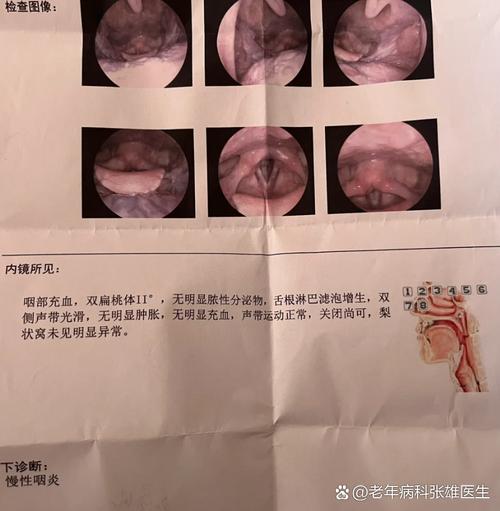 每次使用后要清洗并晾干霧化器 守護療效與健康的關鍵一步